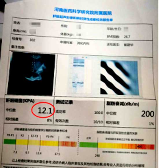 河南郑州治疗肝病最好的医院